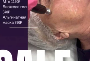Микротоковый лифтинг